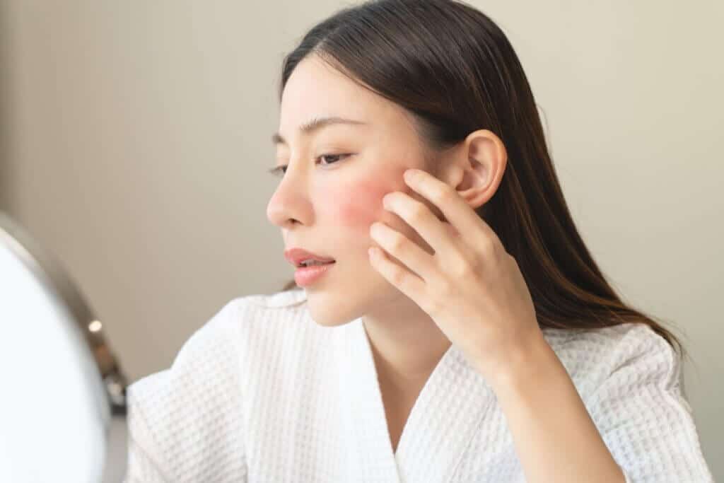 Skincare no inverno: veja erros que podem estar sabotando sua pele